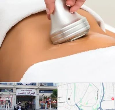 دستگاه لاغری در ایران زمین