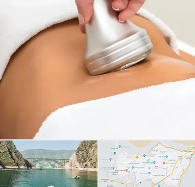 دستگاه لاغری در ایلام