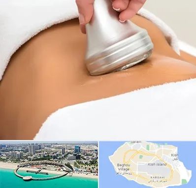 دستگاه لاغری در کیش