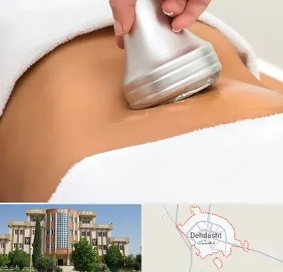 دستگاه لاغری در دهدشت