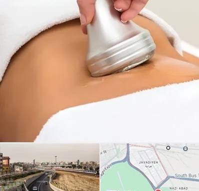دستگاه لاغری در جوادیه