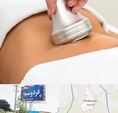 دستگاه لاغری در فردوسیه شهریار