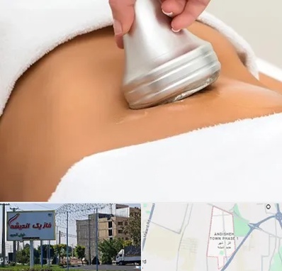 دستگاه لاغری در فاز یک اندیشه