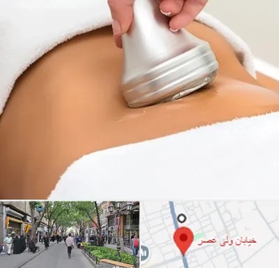 دستگاه لاغری در ولیعصر شهریار