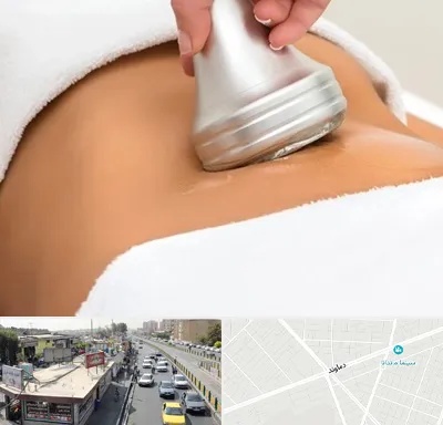 دستگاه لاغری در خیابان دماوند