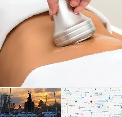 دستگاه لاغری در میدان حر 