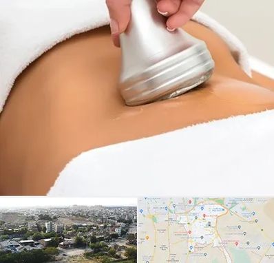 دستگاه لاغری در منطقه 20 تهران 
