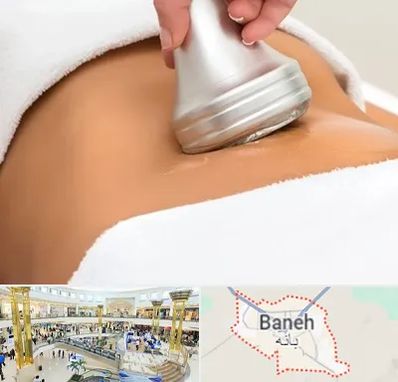 دستگاه لاغری در بانه