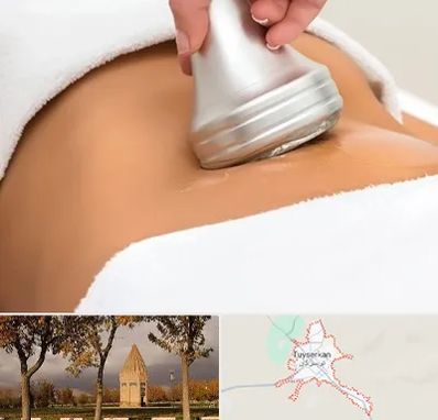 دستگاه لاغری در تویسرکان