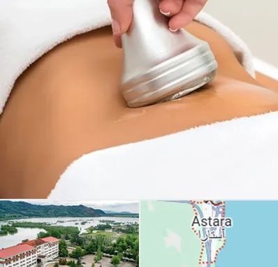 دستگاه لاغری در آستارا