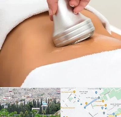 دستگاه لاغری در محلاتی شیراز