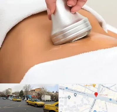 دستگاه لاغری در شهناز تبریز