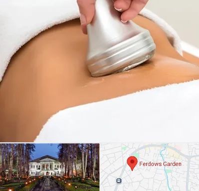 دستگاه لاغری در باغ فردوس