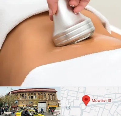 دستگاه لاغری در مولوی