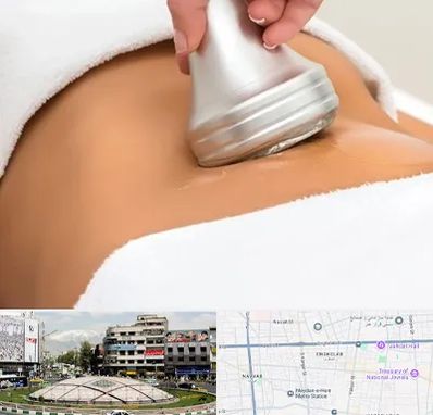 دستگاه لاغری در مرکز تهران