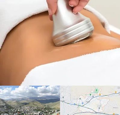 دستگاه لاغری در رودهن