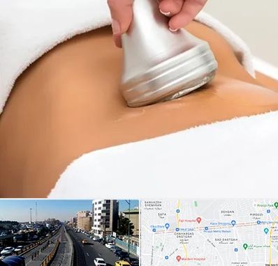 دستگاه لاغری در پیروزی 