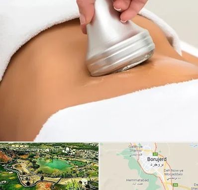 دستگاه لاغری در بروجرد