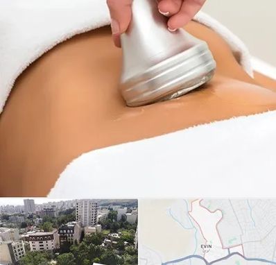 دستگاه لاغری در اوین