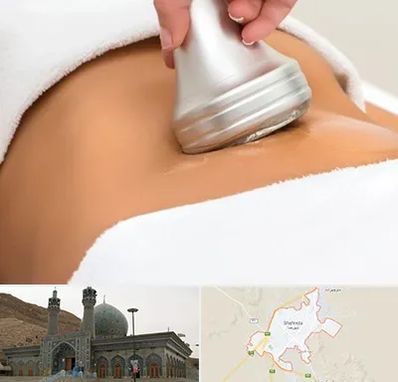 دستگاه لاغری در شهرضا