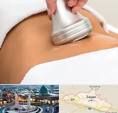 دستگاه لاغری در زنجان