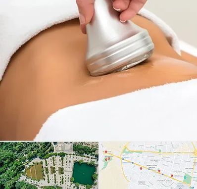 دستگاه لاغری در وکیل آباد مشهد 