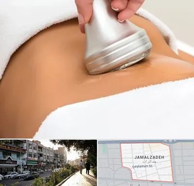دستگاه لاغری در خیابان جمالزاده
