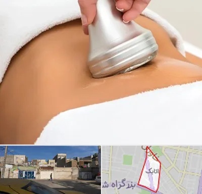 دستگاه لاغری در اتابک