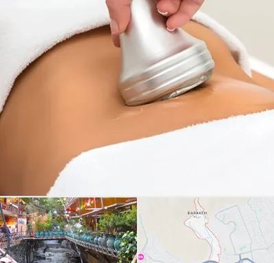 دستگاه لاغری در درکه