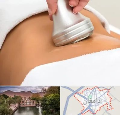 دستگاه لاغری در دامغان