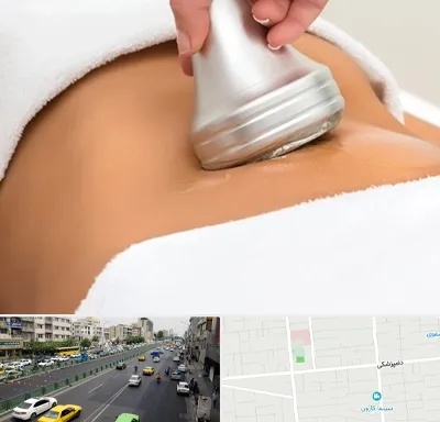 دستگاه لاغری در خیابان دامپزشکی