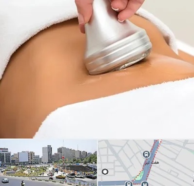 دستگاه لاغری در هفت تیر