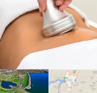 دستگاه لاغری در مهاباد