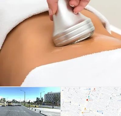 دستگاه لاغری در بلوار کلاهدوز مشهد 