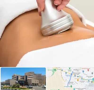 دستگاه لاغری در صیاد شیرازی مشهد 