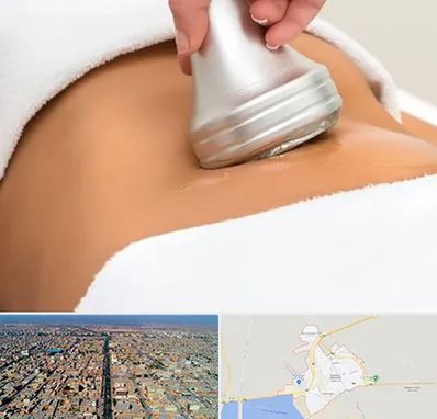 دستگاه لاغری در بندر ماهشهر