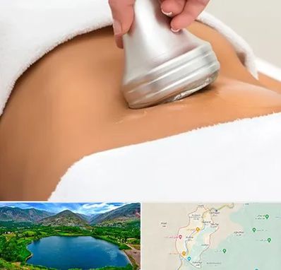 دستگاه لاغری در رودبار