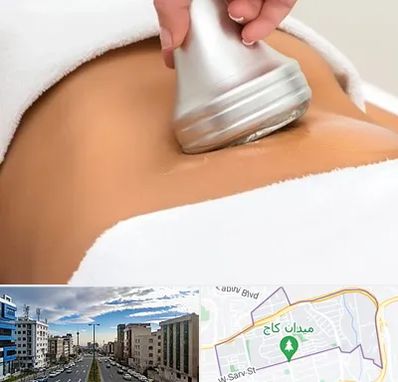 دستگاه لاغری در سعادت آباد 