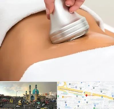دستگاه لاغری در رسالت
