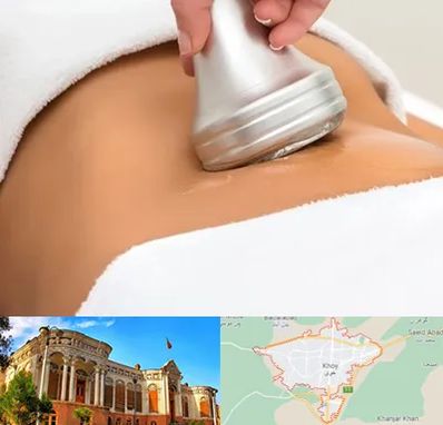 دستگاه لاغری در خوی