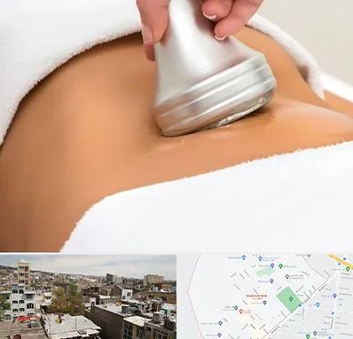 دستگاه لاغری در شمیران نو 