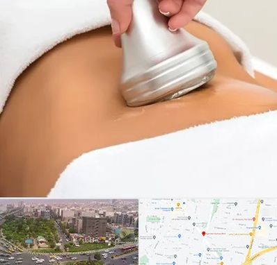 دستگاه لاغری در آیت الله کاشانی