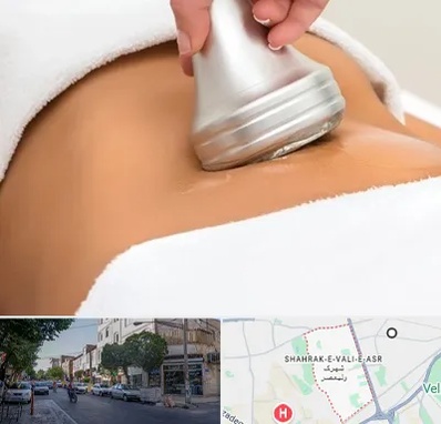 دستگاه لاغری در شهرک ولیعصر