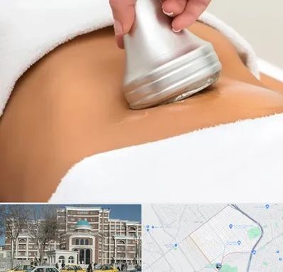 دستگاه لاغری در طلاب مشهد