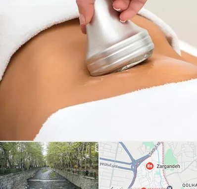 دستگاه لاغری در زرگنده