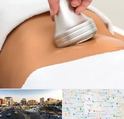 دستگاه لاغری در منطقه 7 تهران 