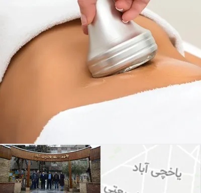 دستگاه لاغری در یاخچی آباد