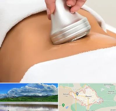 دستگاه لاغری در مرند