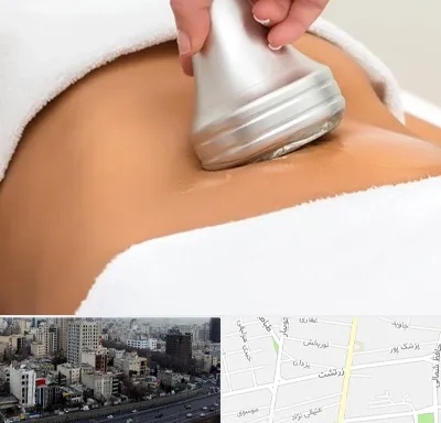 دستگاه لاغری در زرتشت