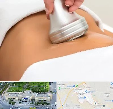 دستگاه لاغری در نسیم شهر